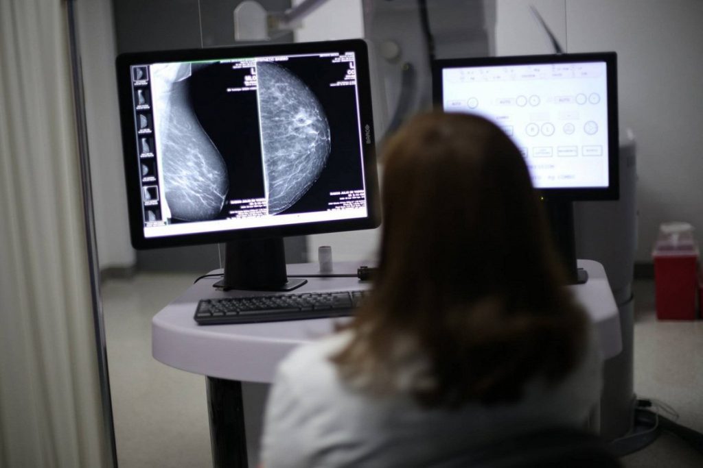 Mammographie 